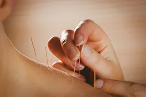 Acupuncture Course